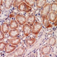 Polyclonal Rabbit anti-Human I-BABP / FABP6 Antibody (IHC, IF, WB)