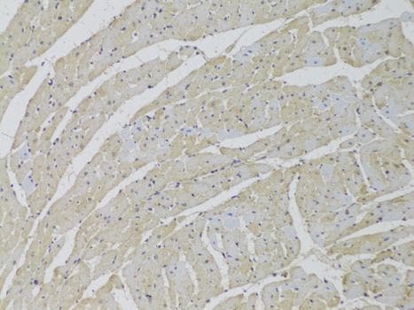 LIMPII / SCARB2 Antibody