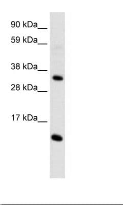 CCL18 / PARC Antibody (C-Terminus)