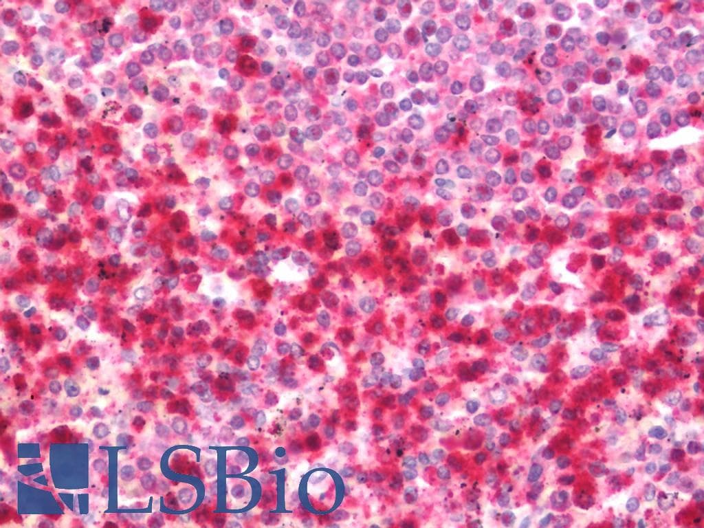 IHC-plus™ WDR61 Antibody