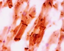 CTNNA3 / Alpha-3 Catenin Antibody (clone 892_24D2S)