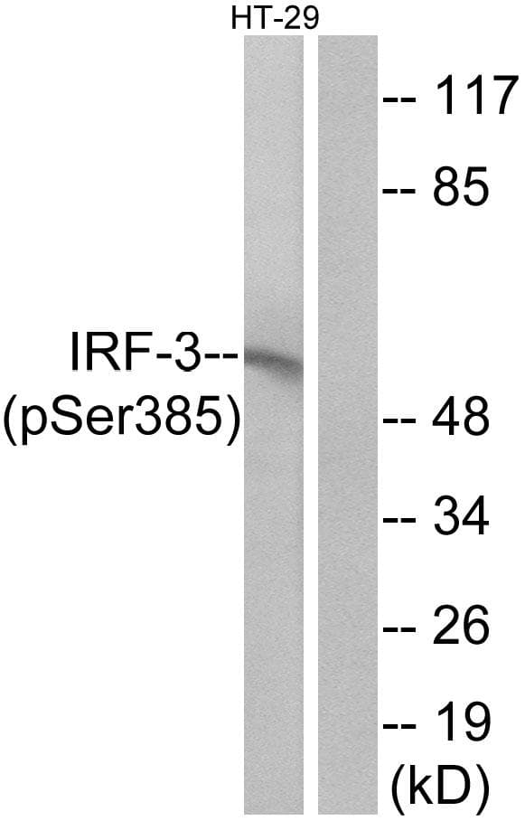 IRF3 Antibody (phospho-Ser385)