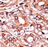 ABL1 / c-ABL Antibody (phospho-Tyr134)
