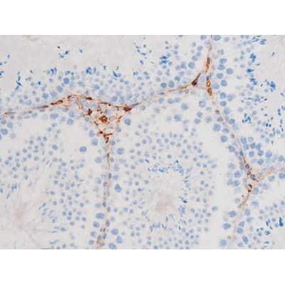 Polyclonal Rabbit anti-Human SYK Antibody (phospho-Tyr348, IHC, IF, WB)