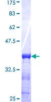 Human CMPK2 Protein (Recombinant GST, N-terminus)