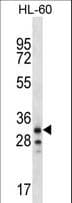 OR6K2 Antibody (aa276-304)