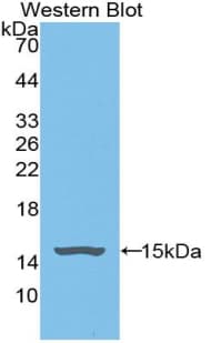 GPT / Alanine Transaminase Antibody (aa367-480)