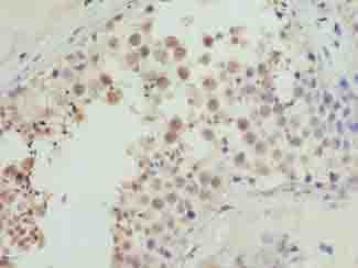 Polyclonal Rabbit anti-Human CDADC1 Antibody (IHC)