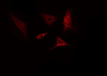 Polyclonal Rabbit anti-Human SLC39A4 / ZIP4 Antibody (IF, WB)