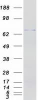 Human ALDP / ABCD1 Protein (Recombinant Myc-DDK (Flag))