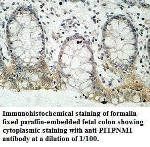 PITPNM1 / NIR2 Antibody (aa213-468)