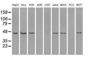PathPlus™ NF45 / ILF2 Antibody (clone OTI6F1)