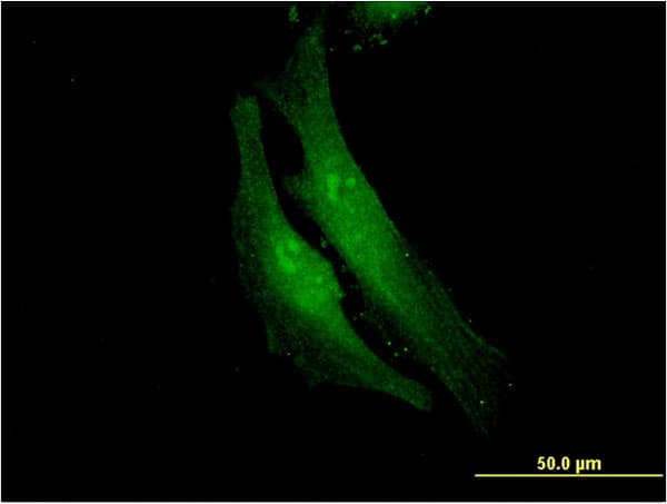 FANCF Antibody (clone 3C4)