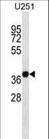 CD320 Antibody (aa153-182)