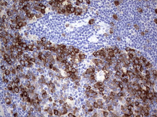 Monoclonal Mouse anti-Human R1 / RRM1 Antibody (clone OTI16A8, aa541-792, IHC, WB)