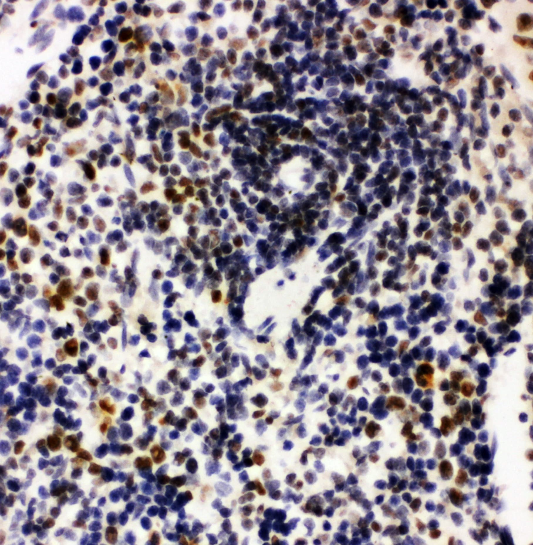 Polyclonal Rabbit anti-Human NPM1 / NPM / Nucleophosmin Antibody (aa22-41, IHC, WB)