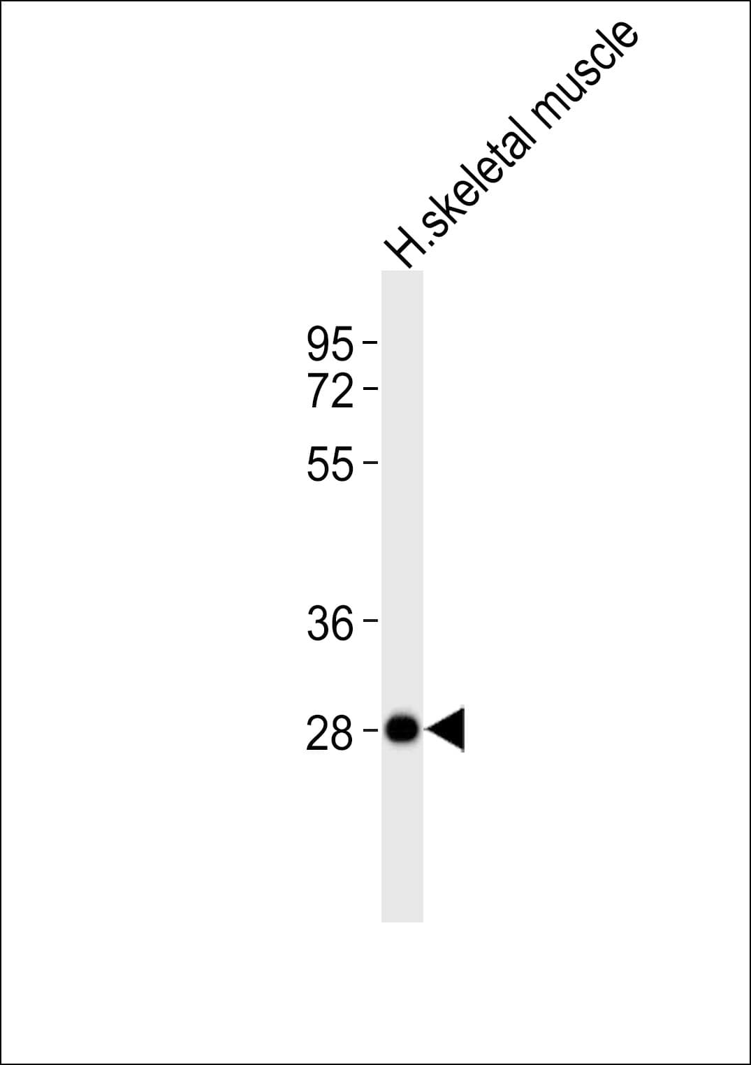 NEURL2 Antibody
