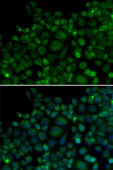 TLR7 / CD287 Antibody