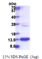 Human COMMD6 Protein (Recombinant His)