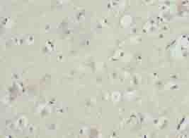 Polyclonal Rabbit anti-Human ZNF821 Antibody (IHC, WB)