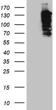 SH3PXD2A / TKS5 Antibody (aa299-395, clone OTI4B8)