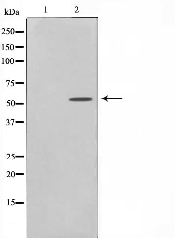 TTC23 Antibody
