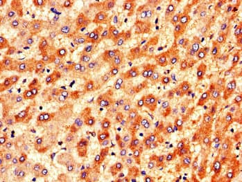 Polyclonal Rabbit anti-Human DGAT2 Antibody (IHC, IF, WB)