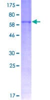 Human FMOD / Fibromodulin Protein (Recombinant GST)