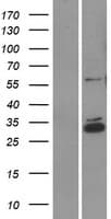 CCDC90B Protein (Over-Expression Lysate Myc-DDK (Flag))