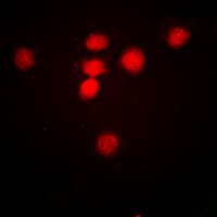Polyclonal Rabbit anti-Human CREBBP / CREB Binding Protein Antibody (Acetyl-Lys1535, IHC, IF, WB)