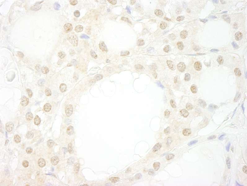 WDR20 Antibody (aa450-500)