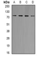 GARS / Glycyl tRNA Synthetase Antibody