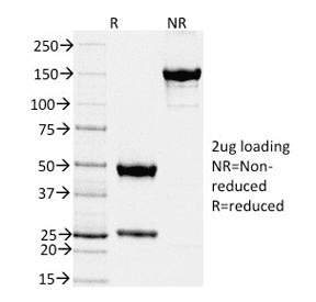 TIMP2 Antibody (clone TIMP2/2044)