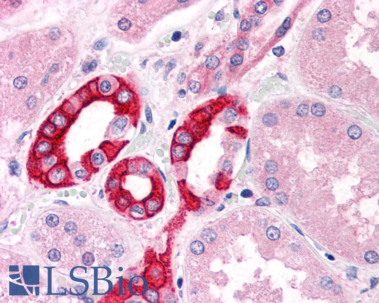 IHC-plus™ Polyclonal Rabbit anti-Human GM2A Antibody (Internal)