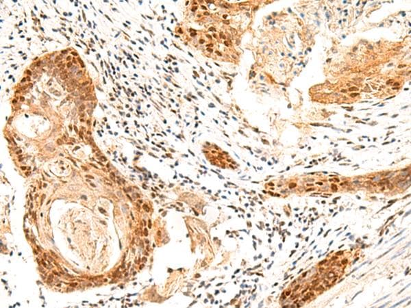 Polyclonal Rabbit anti-Human SETMAR Antibody (IHC)