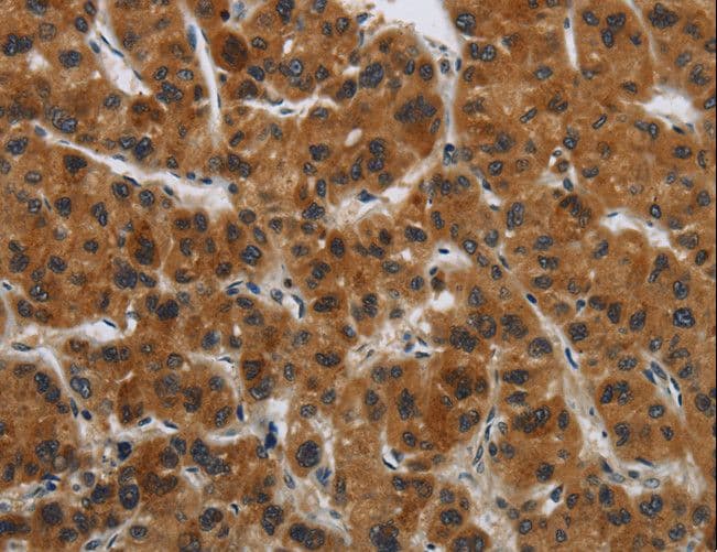 GATA5 Antibody
