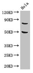 Polyclonal Rabbit anti-Human KBTBD6 Antibody (IHC, IF, WB)