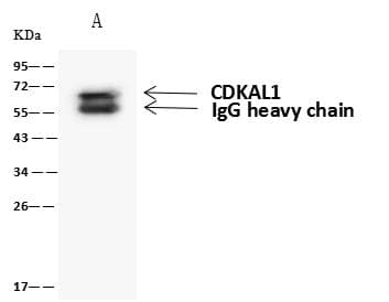 Polyclonal Rabbit anti-Human CDKAL1 Antibody (WB)