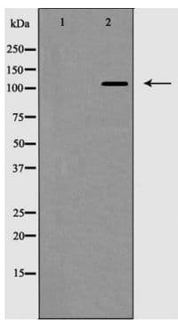 EPHB2 / EPH Receptor B2 Antibody