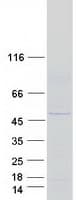 Human KLHDC3 Protein (Recombinant Myc-DDK (Flag))