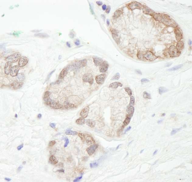 UBE2L3 / UBCH7 Antibody (aa100-C-term)