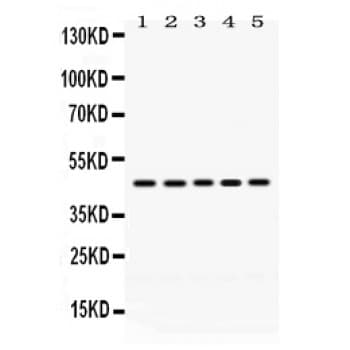 PGK1 / Phosphoglycerate Kinase Antibody (aa312-337)
