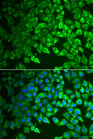 GIF / Intrinsic Factor Antibody