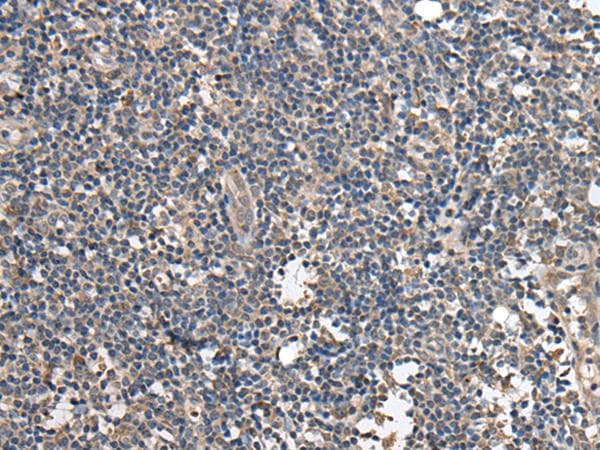 Polyclonal Rabbit anti-Human BRI3BP Antibody (IHC, WB)