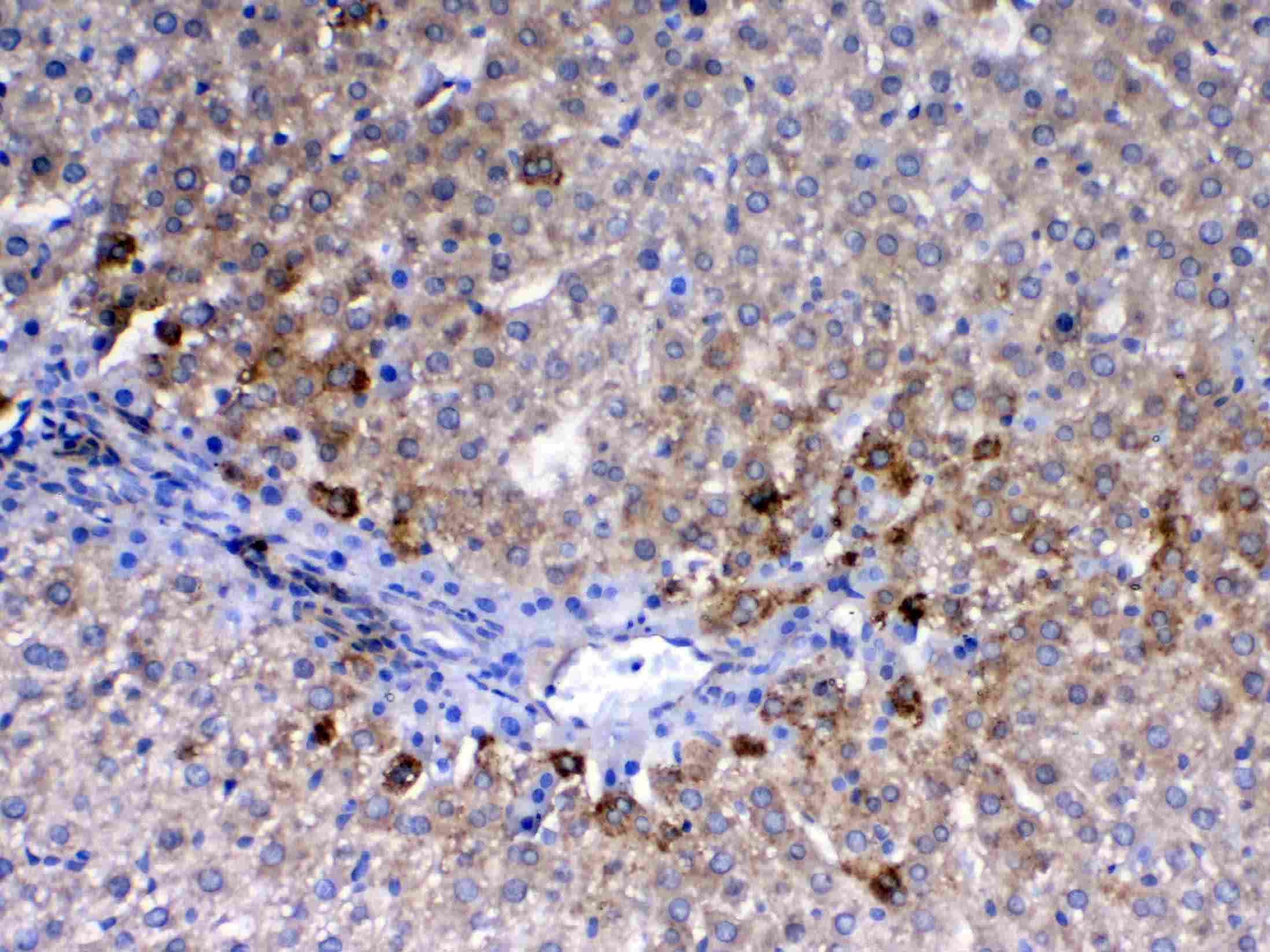 CD105 Antibody