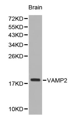 Polyclonal Rabbit anti-Human VAMP2 / VAMP-2 Antibody (IHC, WB)