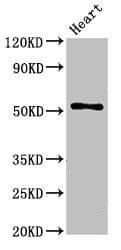 Polyclonal Rabbit anti-Human FGG / Fibrinogen Gamma Antibody (IHC, IF, WB)