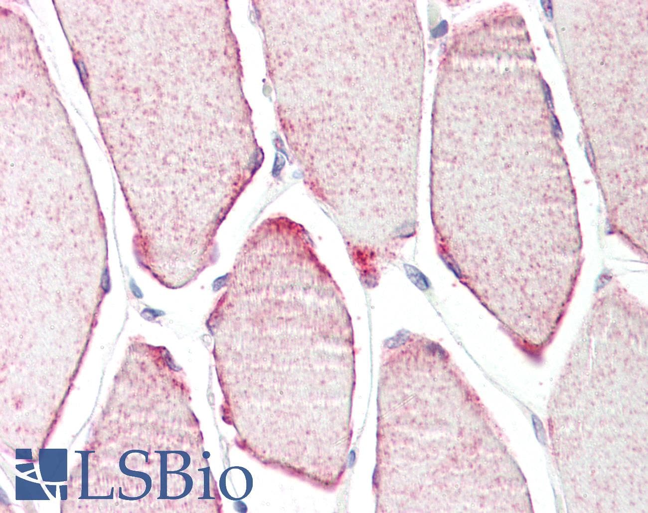 IHC-plus™ TRIM54 / MURF Antibody (aa388-400)