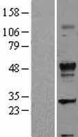 Human TGFB2 / TGF Beta2 Protein (Over-Expression Lysate Myc-DDK (Flag))