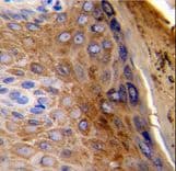KRT10 / CK10 / Cytokeratin 10 Antibody (aa318-346)